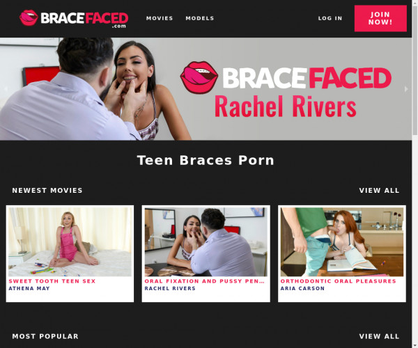 brace faced